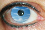 skyeye